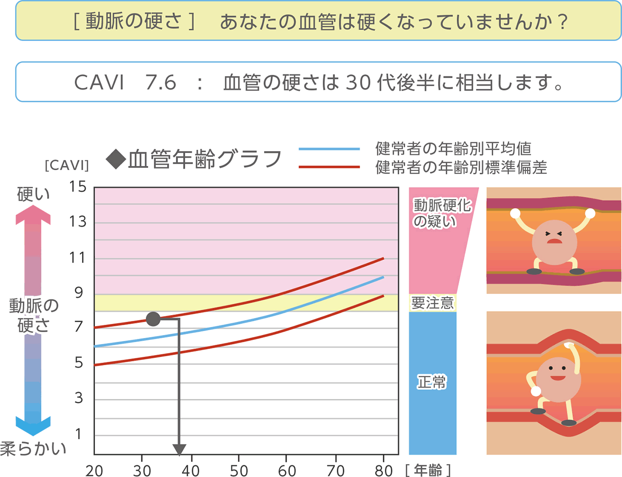 脈波検査